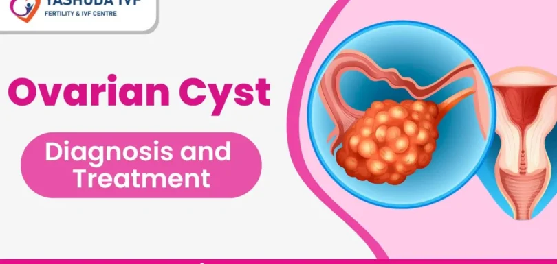 ovarian cyst diagnosis and treatment