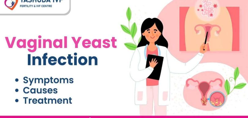 Vaginal-Yeast--Infection-Symptoms-Causes-Treatment